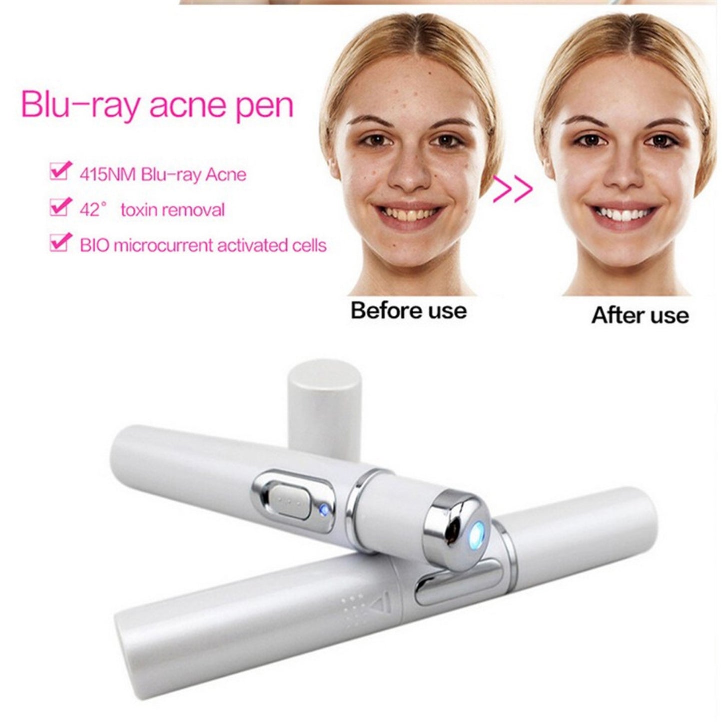 Therapy Acne Laser Pen