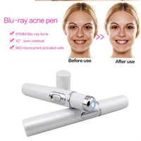 Therapy Acne Laser Pen
