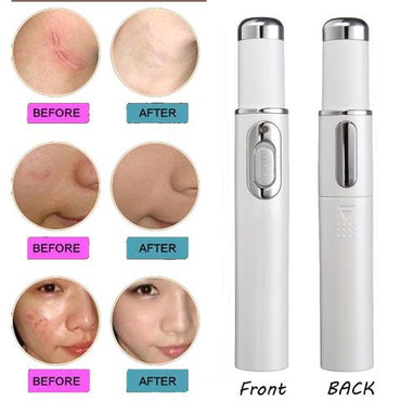 Therapy Acne Laser Pen